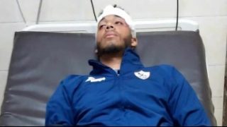 لاعبو الزمالك يكشفون تفاصيل إصابات مباراة فيوتشر 2005